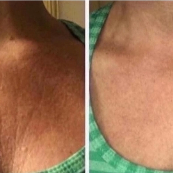 Smooth The Cellulite - Picture 5 of 7